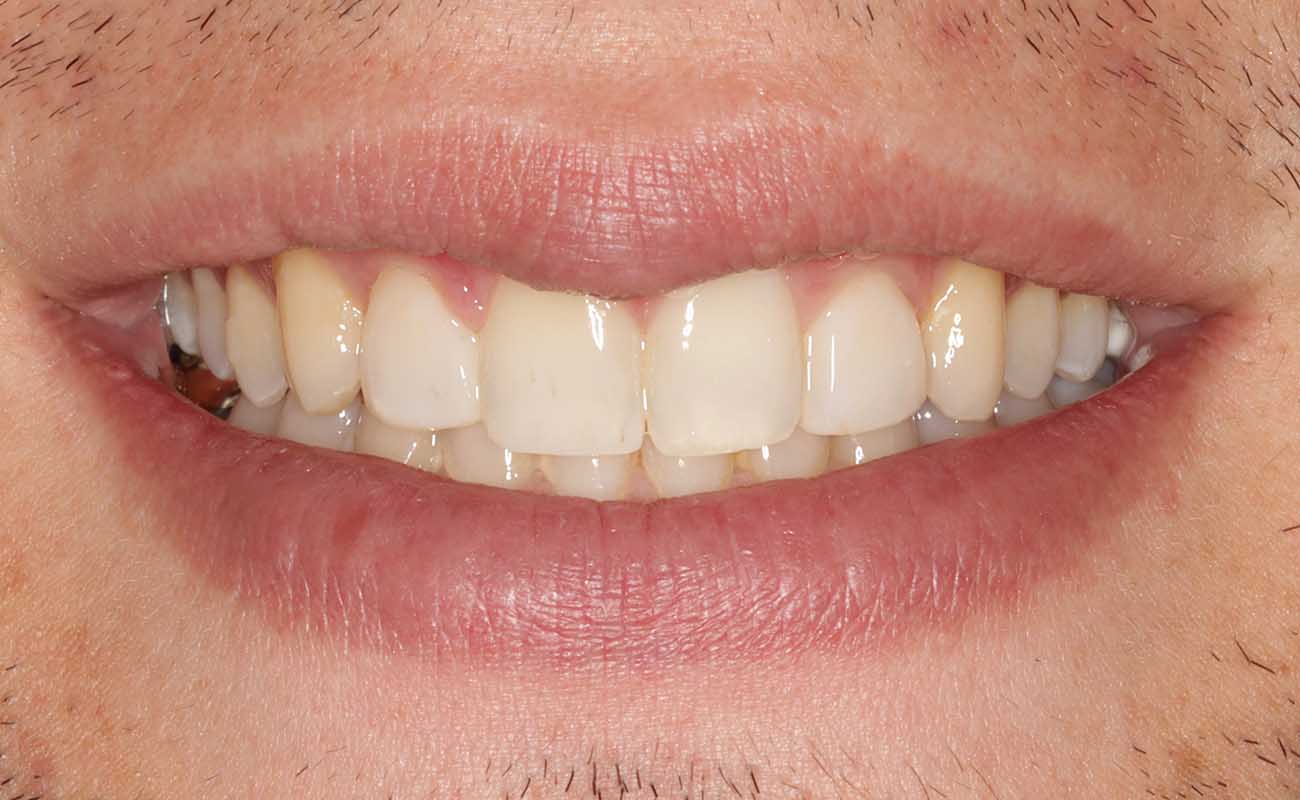 Treatment After Image Reading | Aspire Clinic