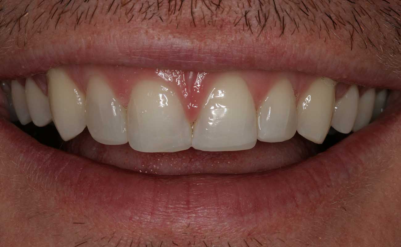 Treatment After Image Reading | Aspire Clinic