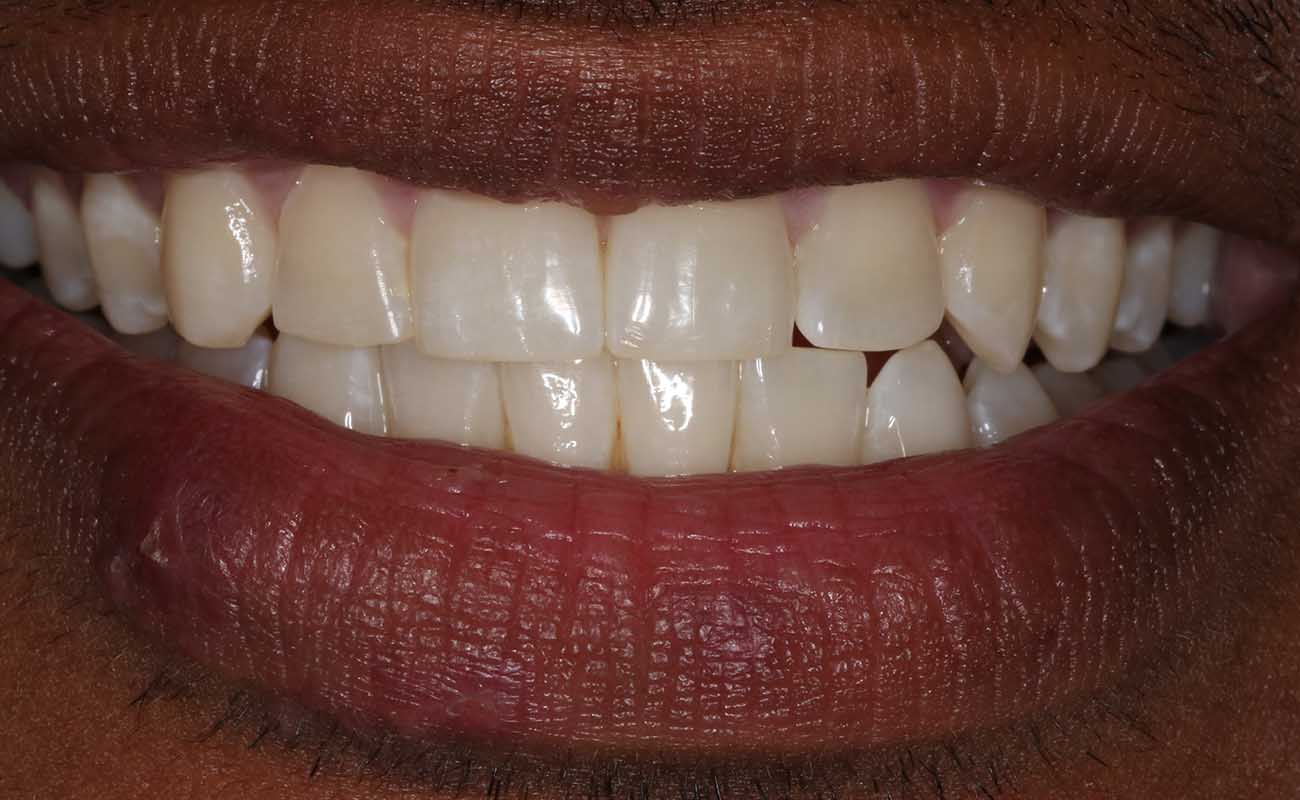 Treatment After Image Reading | Aspire Clinic