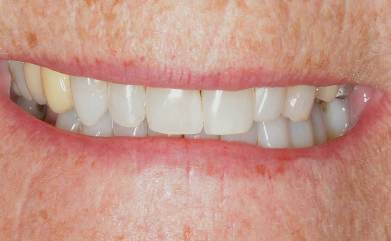 Treatment After Image Reading | Aspire Clinic